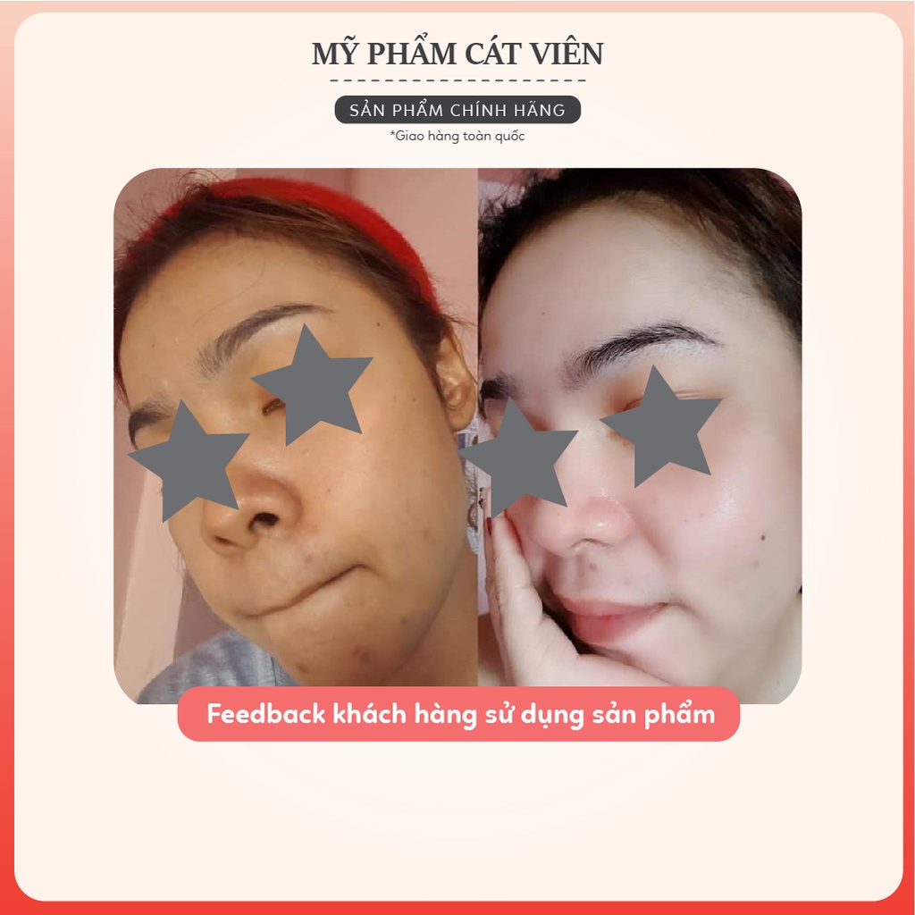 Serum dưỡng trắng Derma, chăm sóc da giảm thâm mờ nám tàn nhang, dưỡng trắng, dưỡng ẩm Me'dream WHITENING SERUM