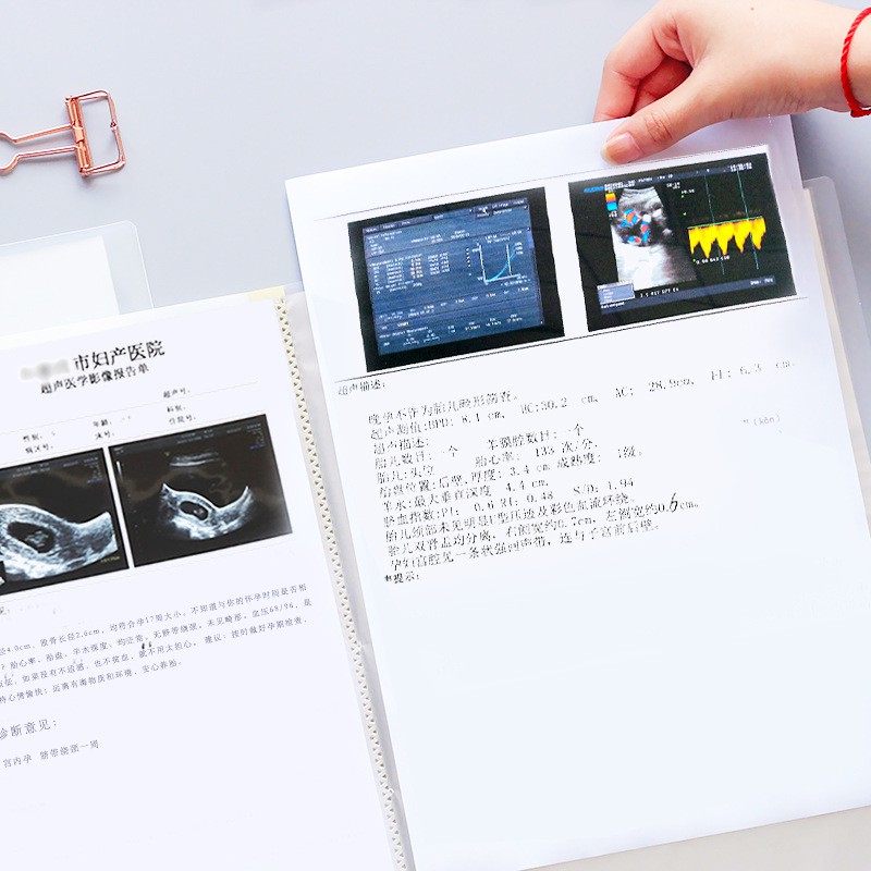 File lá, bìa lá A4 Wengu - 20 ngăn / 40 ngăn / 60 ngăn