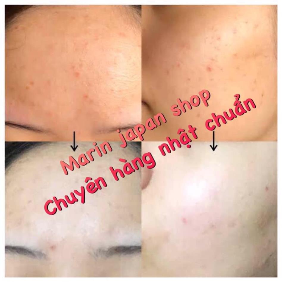 Kem dưỡng đa năng Oronine H Ointment Nhật Bản