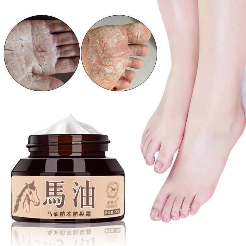 Kem dầu ngựa hàng chuẩn nội địa Trung: nứt nẻ, khô ráp chân tay