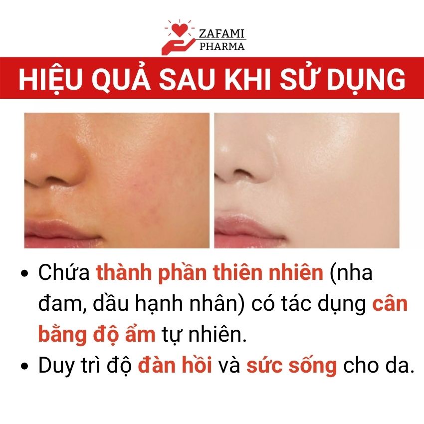 Kem dưỡng ẩm body dưỡng trắng da toàn thân dưỡng da trắng da dưỡng ẩm Fixderma Mosturizing (60g) Zafami Pharma | BigBuy360 - bigbuy360.vn
