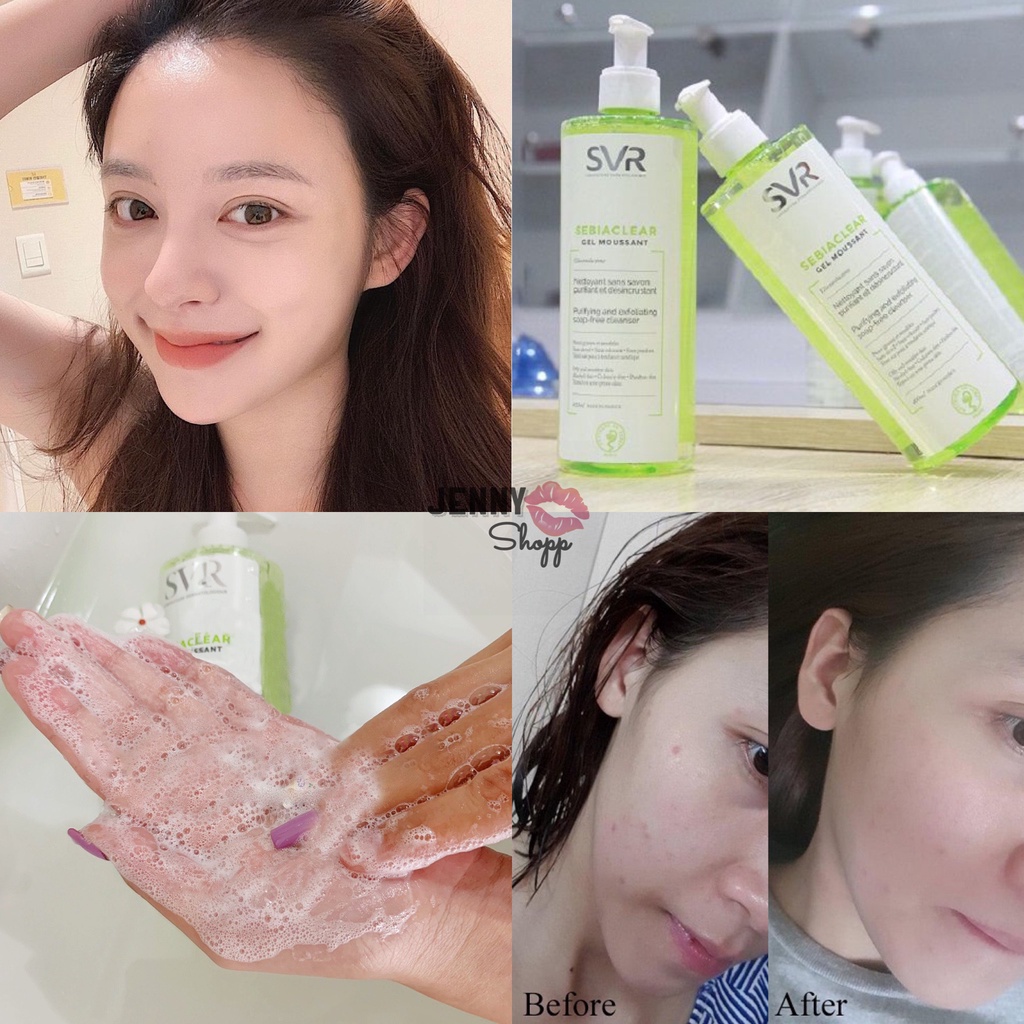 Sữa Rửa Mặt Dạng Gel SVR Sebiaclear Gel Moussant
