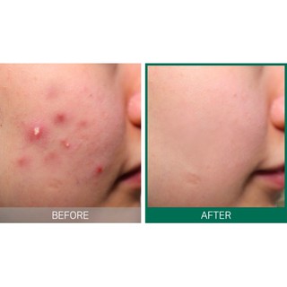 Serum Some By Mi AHA-BHA-PHA 30 Days Miracle