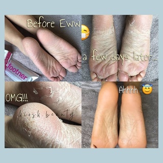 [FOOTNER] VỚ Ủ LỘT DA CHÂN - HÀNG UK