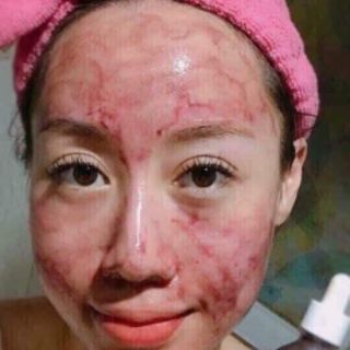 RED PEEL TINGLE SERUM