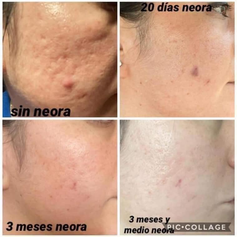 Neostrata Retinol Repair Complex 0,5 % Phục Hồi, Ngăn Ngừa Lão Hóa