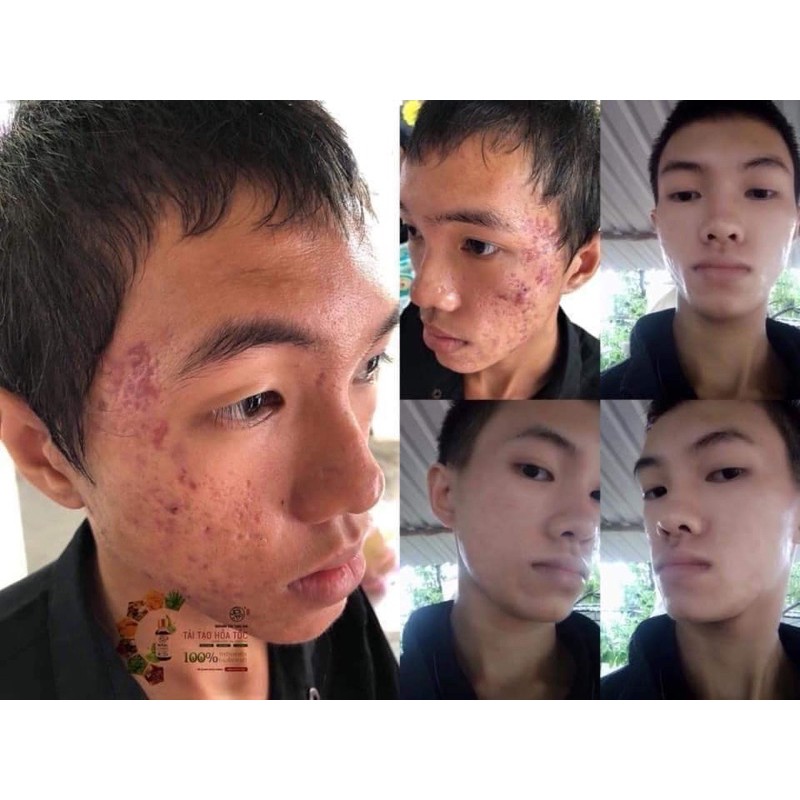 Serum tái tạo Hoả Tốc Bà Lão