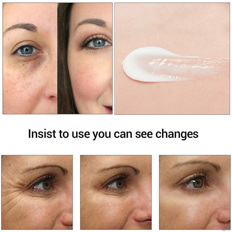 [Hàng mới về] Kem Dưỡng Da Vùng Mắt Loại Bỏ Quầng Thâm Và Nếp Nhăn Tiện Dụng 25g