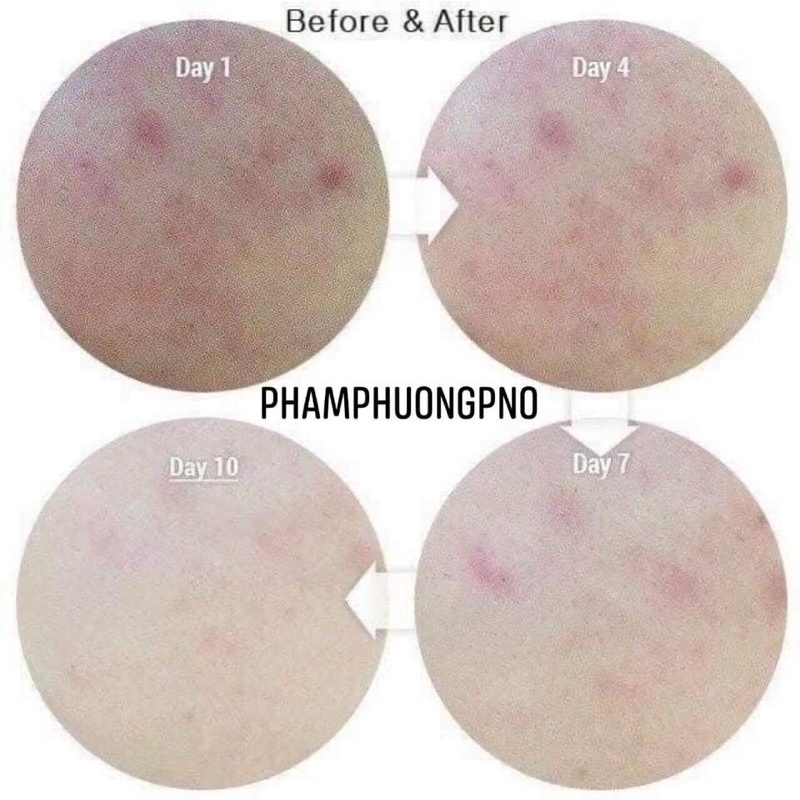 Gel dưỡng mờ thâm Melano CC