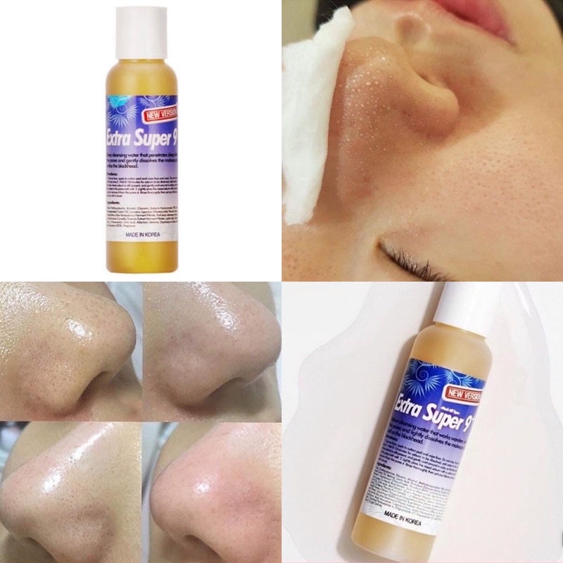 DUNG DỊCH Ủ MỤN ĐẦU ĐEN SPA MEDIPEEL EXTRA SUPER 9+ 100ml