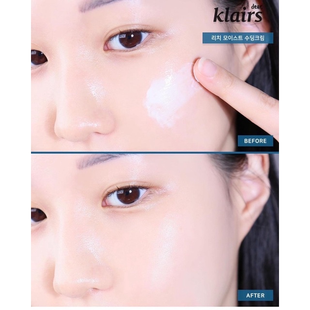 Dưỡng Da Klairs Rich Moist Soothing Serum / Cream