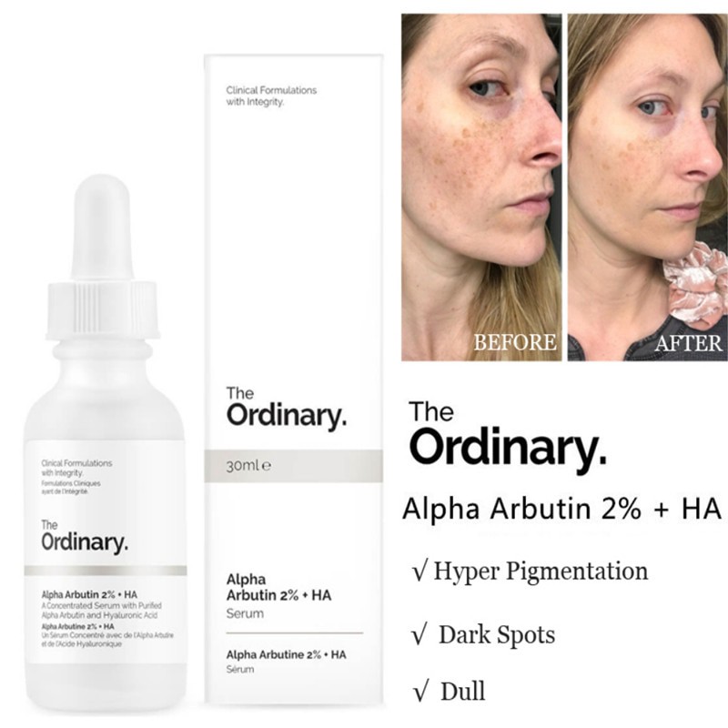 The Ordinary Alpha Arbutin 2% + HA The Ordinary chính hãng / Serum Dưỡng Trắng