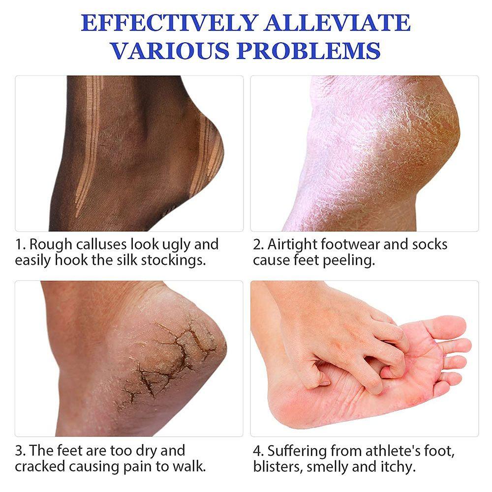 [Hàng mới về] Đá bọt chăm sóc sức khỏe tẩy tế bào chết cho chân