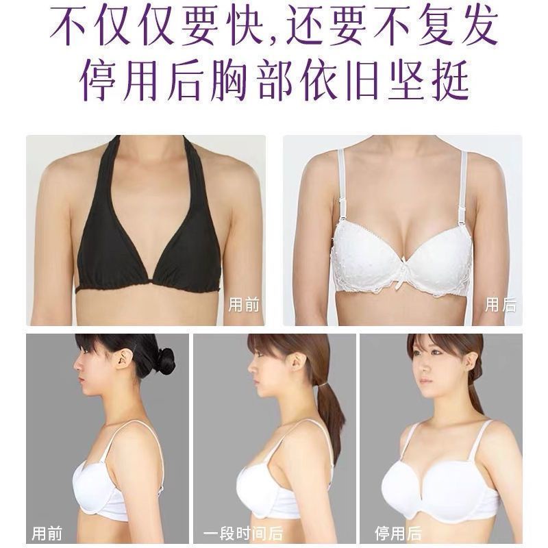 Kem Dán Ngực Nở Ngực Lớn Dành Cho Phụ Nữ Mang Thai Sau Sinh | BigBuy360 - bigbuy360.vn
