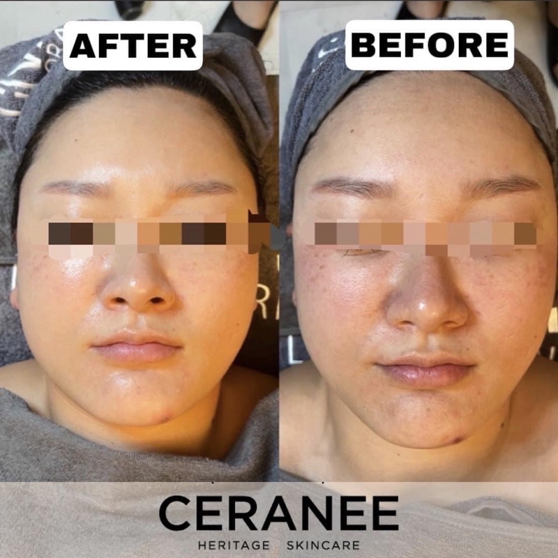 Kem Ceranee phục hồi, dưỡng trắng xoá nhăn da Hàn Quốc chính hãng