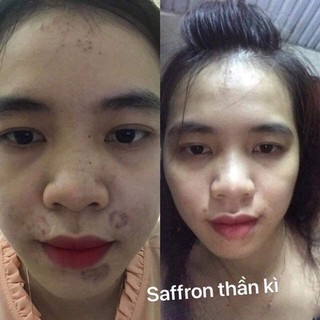 [QUÀ 🎁] Tinh Chất Sâm Đất-Saffron