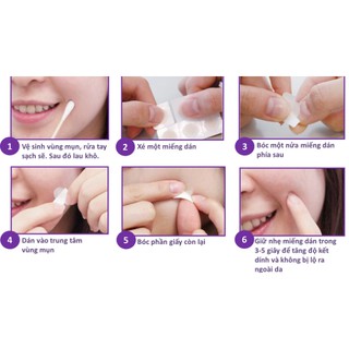 miếng dán mụn cosrx