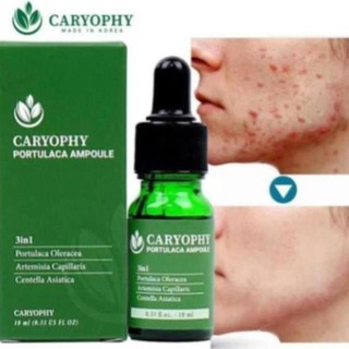 Serum Trị Mụn Thâm Dành Cho Da Nhờn Caryophy 1ml