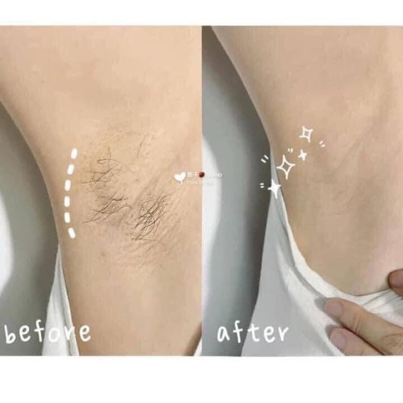 [có che tên] KEM TẨY LÔNG VEET NHẬT 150g, Kem tẩy lông body tặng kèm mút wax tiện lợi dễ sử dụng