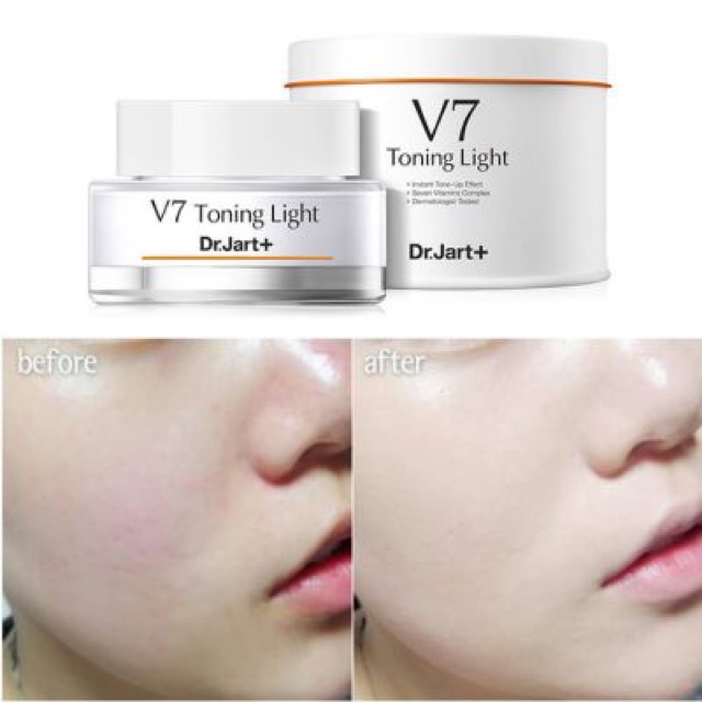 Kem Dưỡng Trắng Da Dr.Jart+ V7 Toning Light 15ml