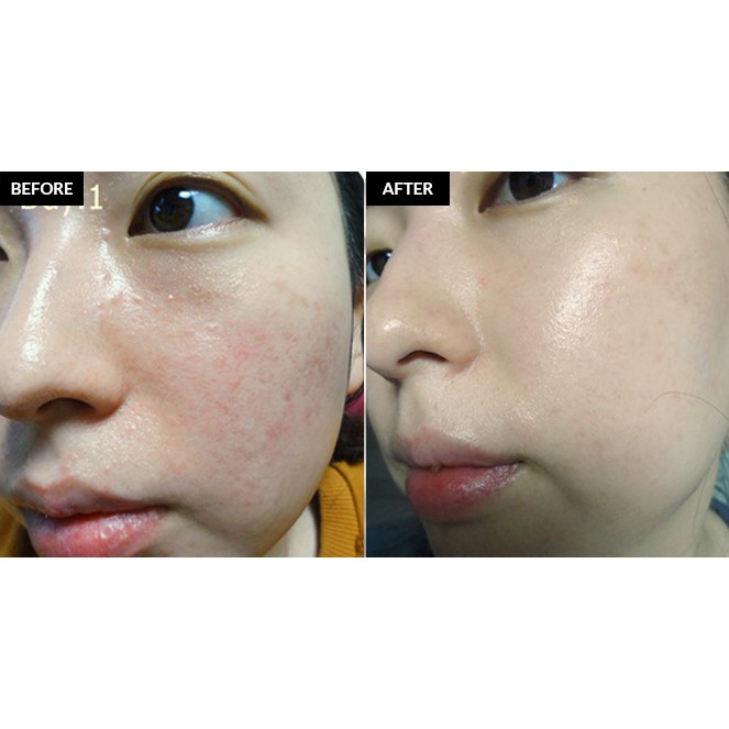 Kem nền Klairs Illuminating Supple Blemish BB Cream 40ml- Miss Xinh