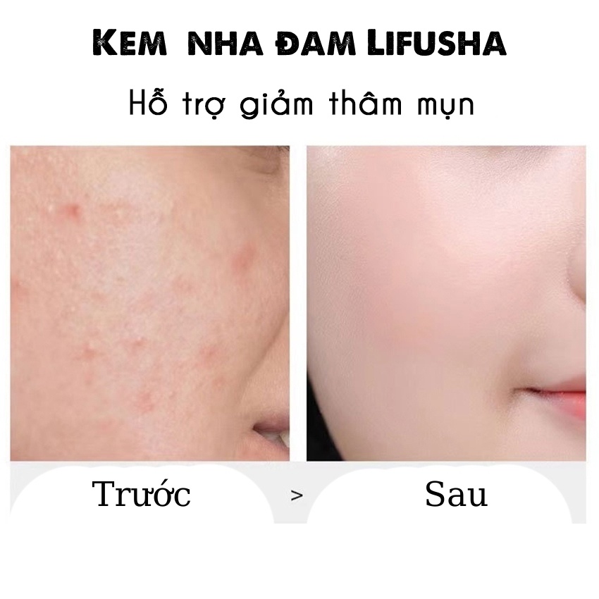 Gel nha đam ☀️ 𝐒𝐀𝐋𝐄 𝐒𝐀̣̂𝐏 𝐒𝐀̀𝐍 ☀️ LIFUSHA,dưỡng ẩm,làm dịu da