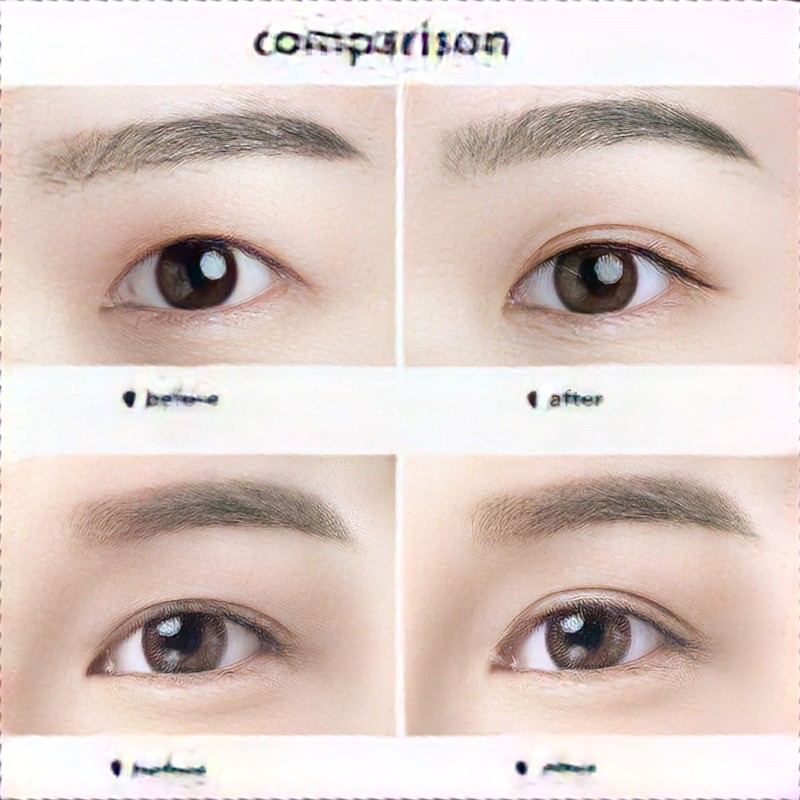 MIẾNG DÁN KÍCH MÍ LƯỚI SẴN KEO DREAM KISS | BigBuy360 - bigbuy360.vn