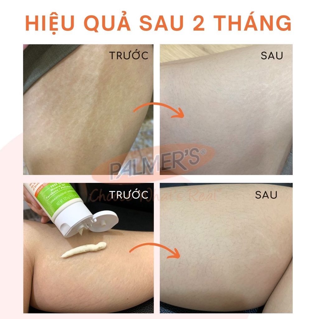 (Mini Size) Bơ đậm đặc tăng cường ngăn ngừa và hỗ trợ điều trị rạn da Palmer's 15g