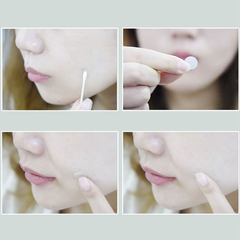 Miếng Dán Che Khuyết Điểm Mụn Vô Hình Chăm Sóc Da