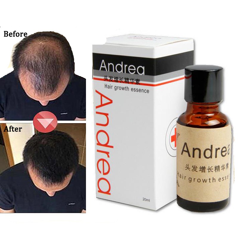 SERUM KÍCH MỌC TÓC ANDREA