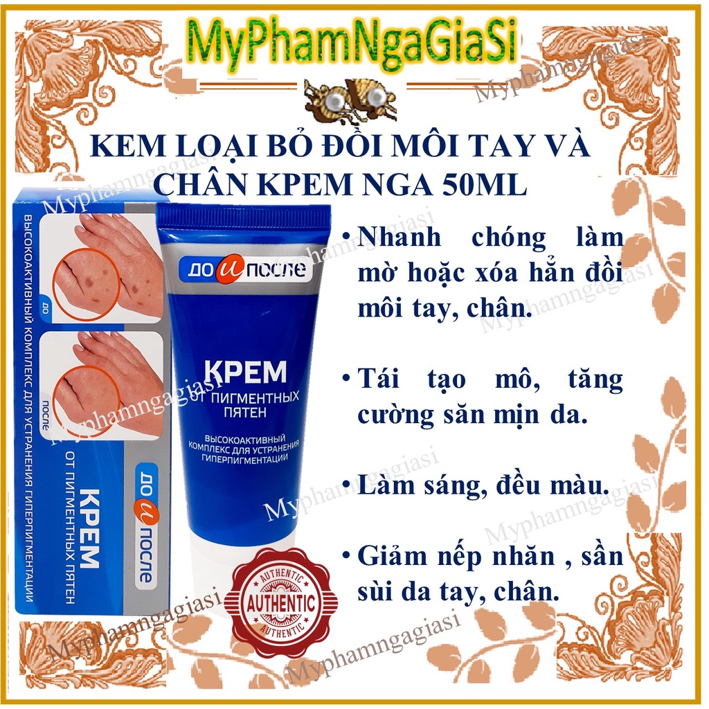 Kem giảm đôi mồi tay chân kpem_ kem đồi môi tay kpem