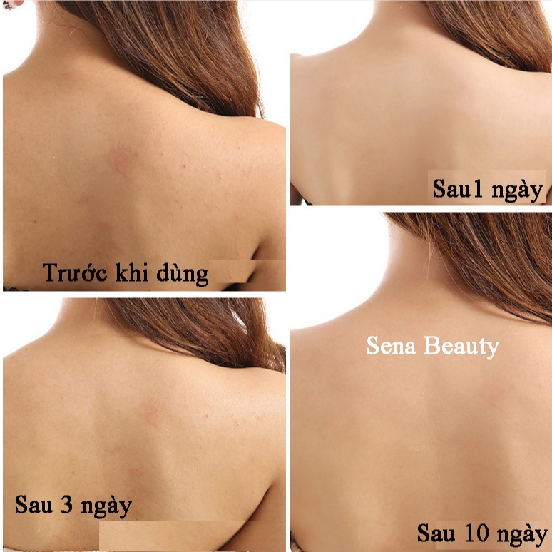 Xà Phòng Muối Biển Cho Mụn Lưng Sea Salt Soap | BigBuy360 - bigbuy360.vn