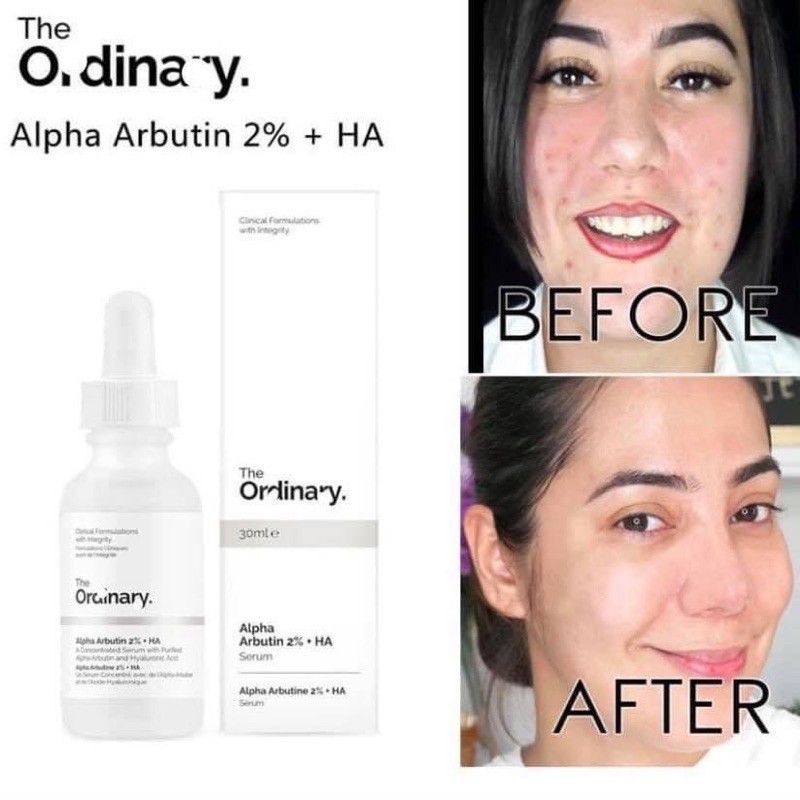 [THE ORDINARY] Tinh chất trắng da mờ thâm The Ordinary Alpha Arbutin 2% + HA 30ml