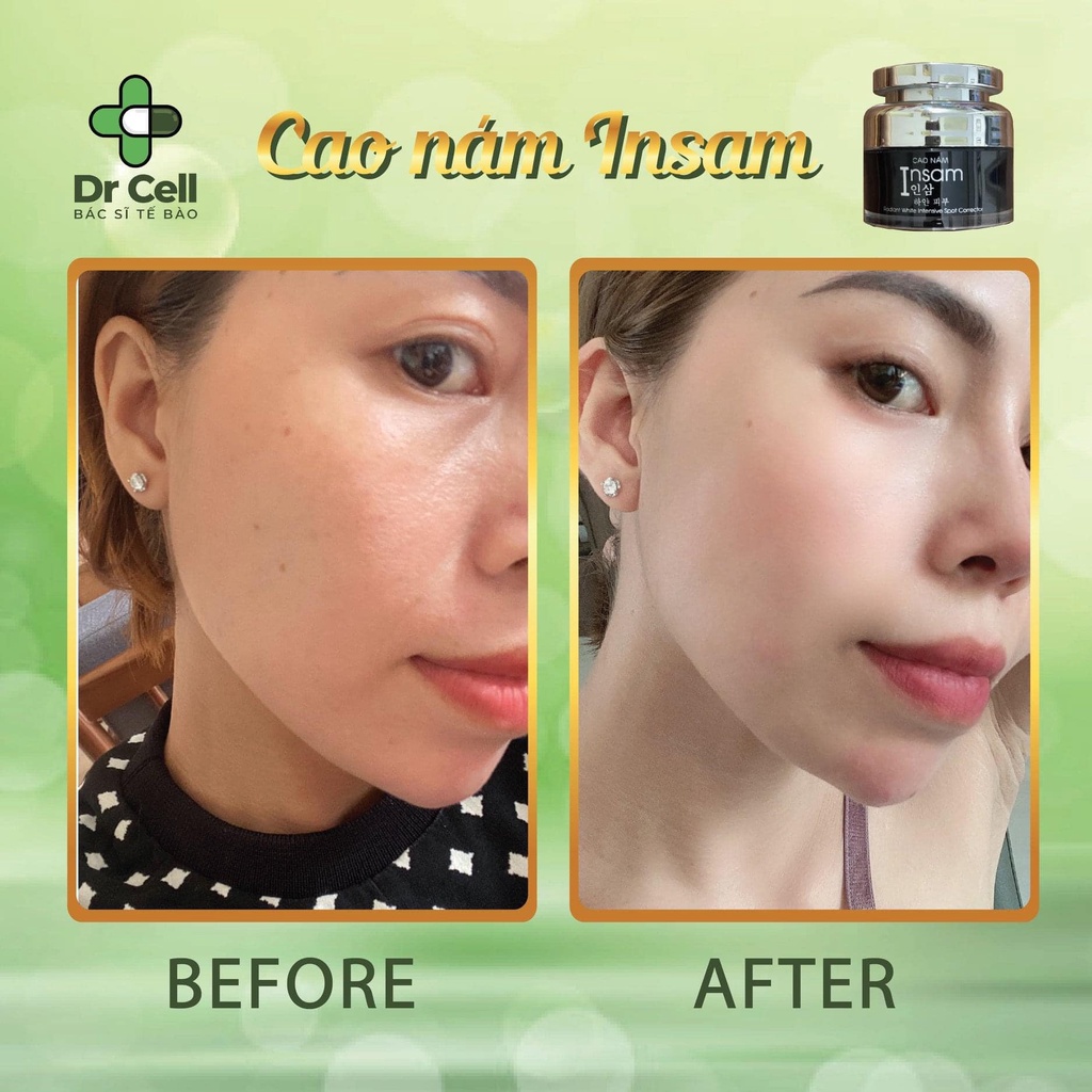 Cao nám Insam Dr Cell làm đẹp da, chống lão hóa, chống nhăn da 20ml SAN16