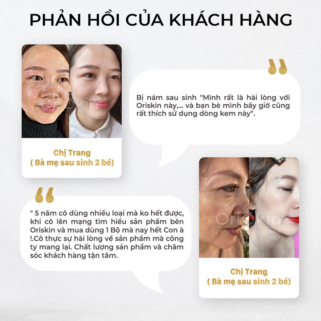 Bộ Sản Phẩm Kem Dưỡng Trắng Da Mặt  Melasma White Perfect 30g, Serum Cho Da Nhạy Cảm Oriskin Brightening Serum 20ml