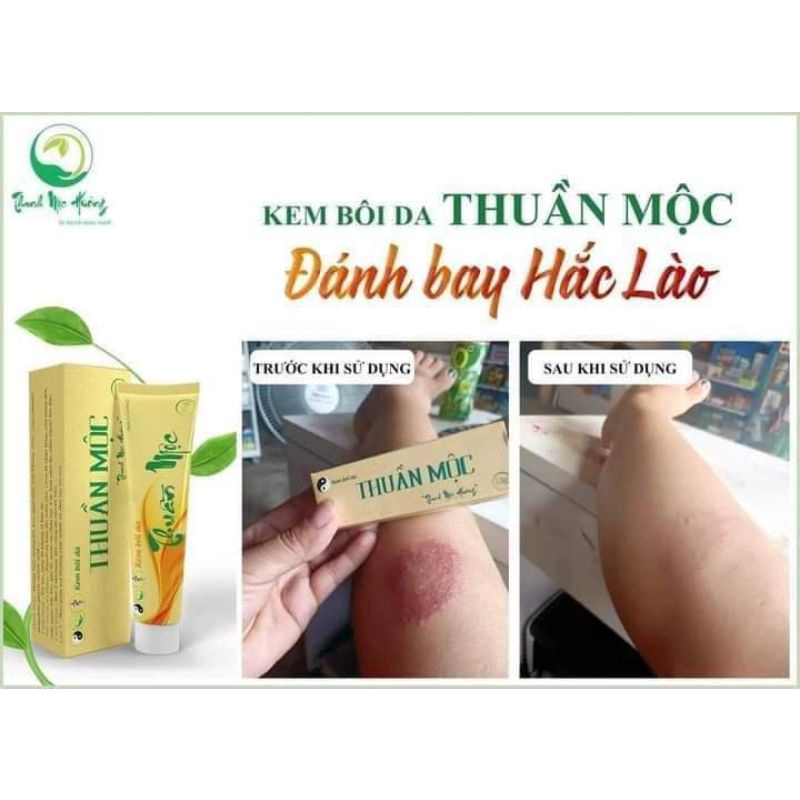 Kem bôi hắc lào ,nấm ngứa .