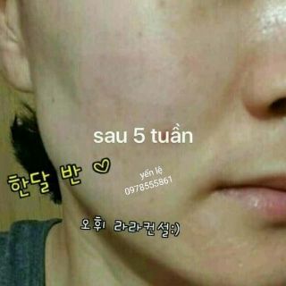 ❌❌COMBO 60 gói tinh chất vàng❌❌