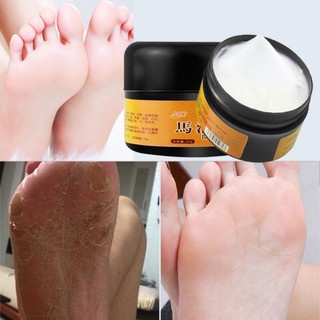K em đ ầu ngựa ngăn ngừa nứt gót chân hũ 30gr hàng nội địa Trung - Kem chống nẻ
