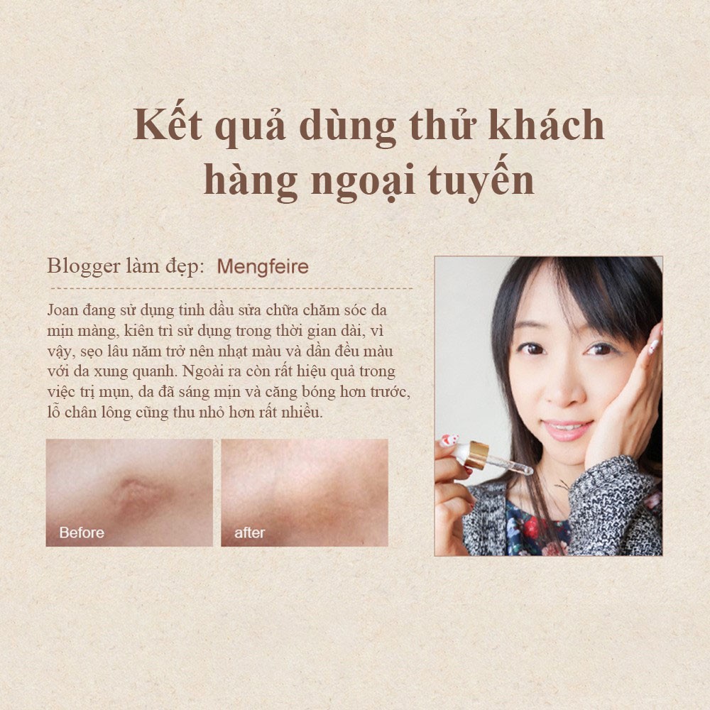 MeiYanQiong TINH CHẤT LAVENDER TÁI TẠO VÀ PHỤC HỒI DA LÀM TRẮNG DA LÀM MỜ SẸO MỤN TRỨNG CÁ | BigBuy360 - bigbuy360.vn