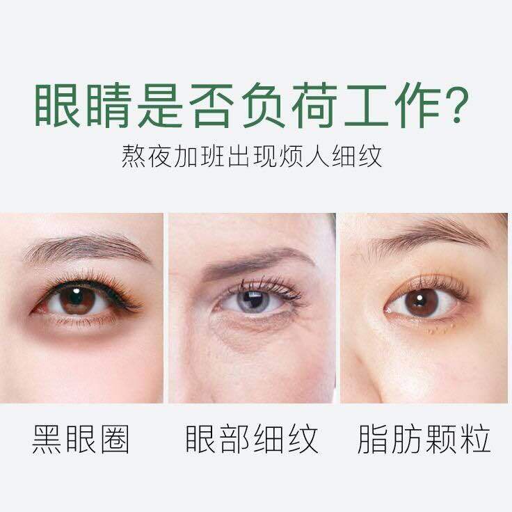 (Hàng Mới Về) Kem Dưỡng Da Vùng Mắt Loại Bỏ Quầng Thâm Nếp Nhăn Bọng Mắt Hiệu Quả | BigBuy360 - bigbuy360.vn