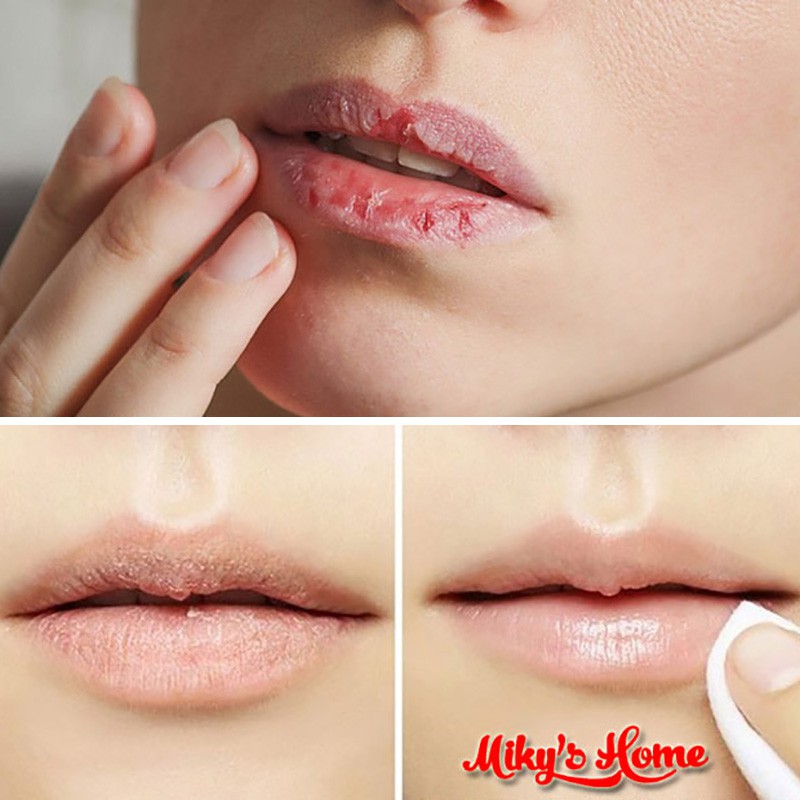 Son tẩy da chết cho môi Kiko Gentle Lip Scrub - Italia Milano | BigBuy360 - bigbuy360.vn