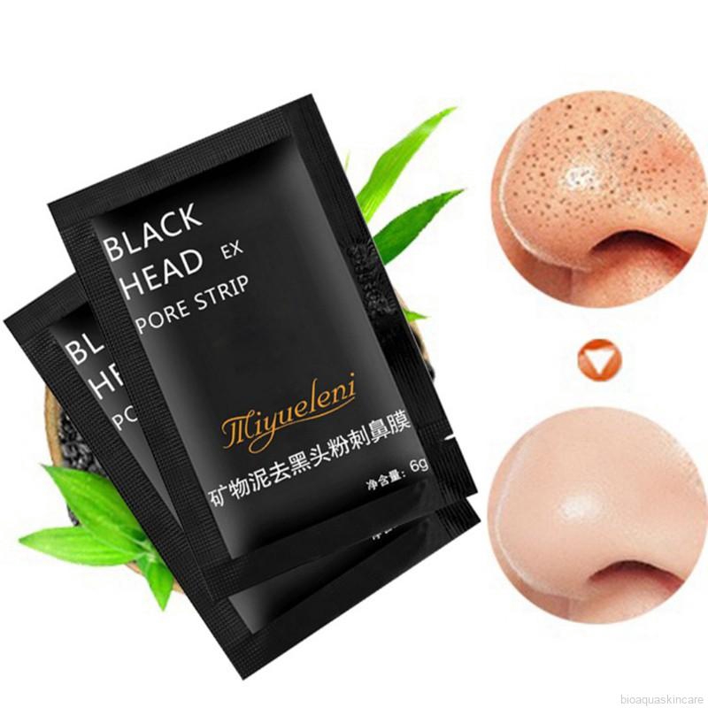 Mặt Nạ Lột Mụn Đầu Đen Dưỡng Ẩm Kiềm Dầu Thu Nhỏ Lỗ Chân Lông | BigBuy360 - bigbuy360.vn