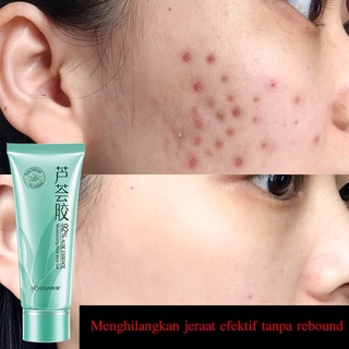 Gel nha đam Rorrec 92% Natural Republic Dưỡng Ẩm