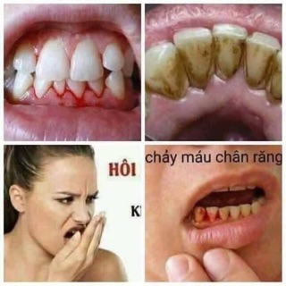 Than tre trắng răng thơm miệng
