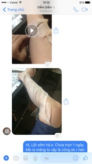 Lột thay da cấp tốc 1 giờ