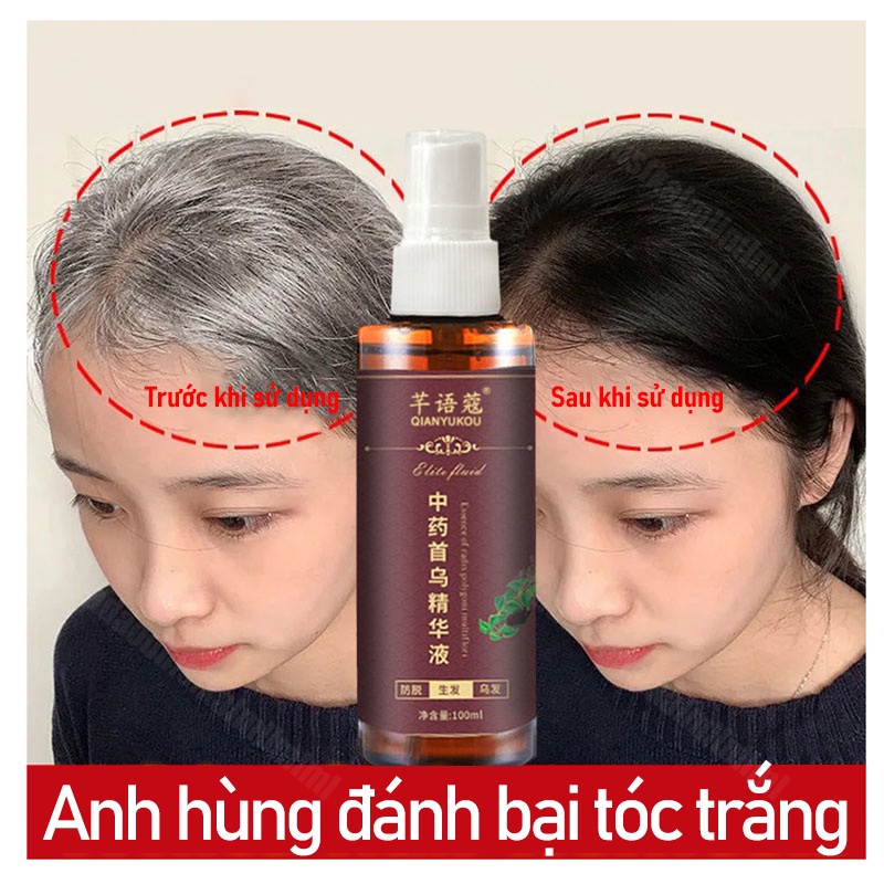 Tinh chất hà thủ ô thảo dược 100ml dầu gội đầu tinh chất thảo dược tóc trắng chuyển đen chống rụng tóc