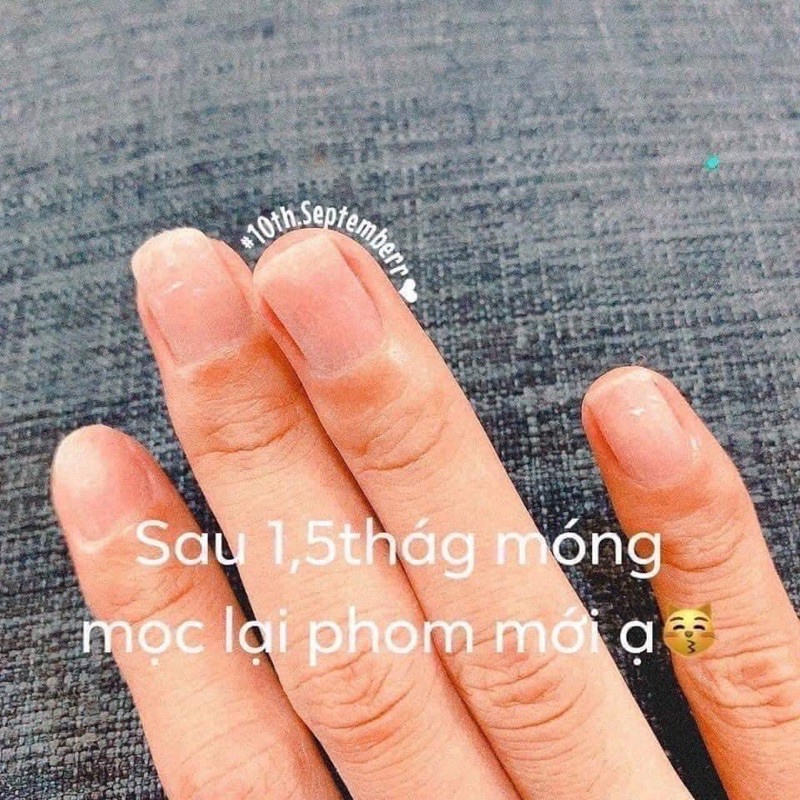 Kem thoa nấm móng tay, phục hồi móng tay Thái Lan