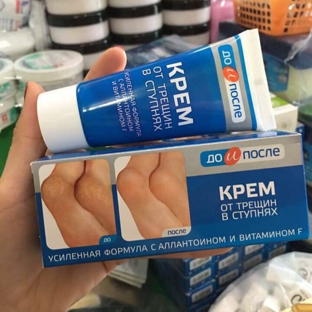 Kem Giảm nứt gót chân Kpem Apteka Nga 50ml Chính Hãng Mới