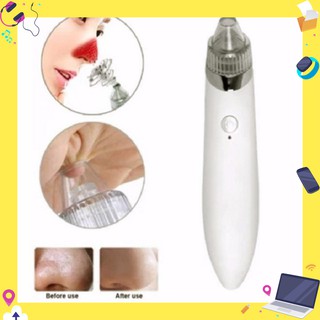 ( Hàng Loại 1 ) Máy Hút Mụn Cầm Tay Cao Cấp New 2020 (NRS)