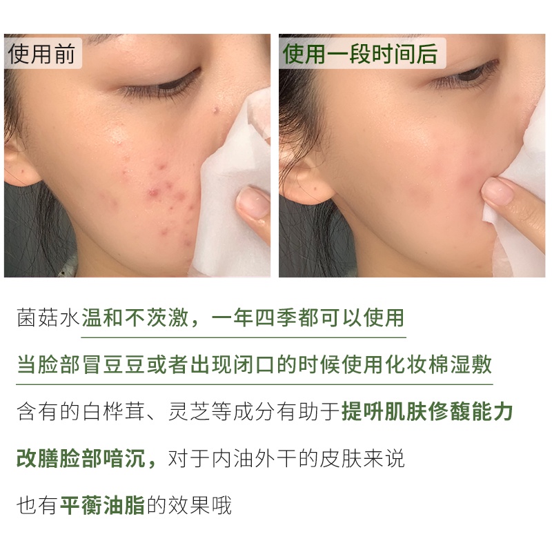 Nước toner Origins tinh chất nấm 200ml